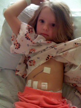 A young child with light brown hair lying on a bed wearing a tiger-patterned hospital gown and orange pants with medical tape on their abdomen.