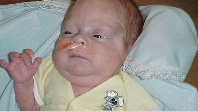 A newborn baby with light skin and reddish hair lying on a white blanket wearing a yellow outfit with a decorative brooch.