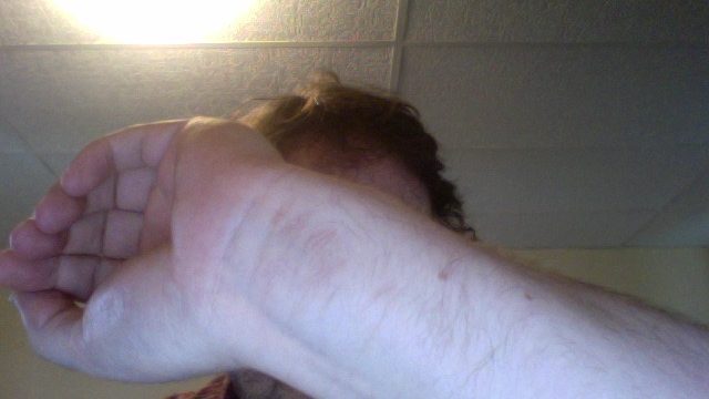 Close-up of a person’s arm and hand covering part of their face. A person's arm and hand are shown in close-up, with the face partially obscured by the hand.
