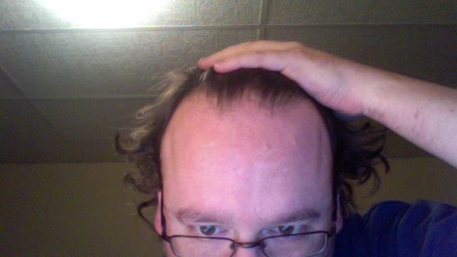 Selfie showing a person's forehead and hand on their head. A person with glasses touching their hairline in a low-angle selfie.